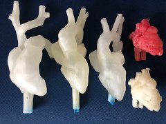 LMU Klinikum 3D-gedruckte Herzmodelle